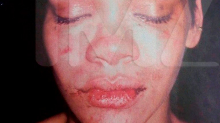 Forslått Rihanna