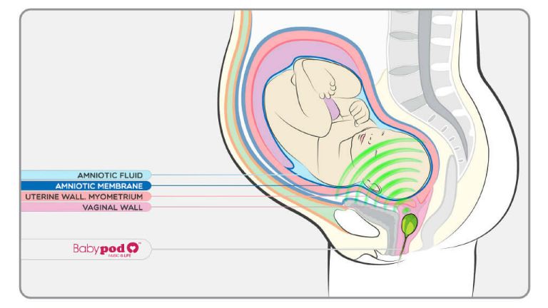 Musikk: Høyttaler til vagina selges