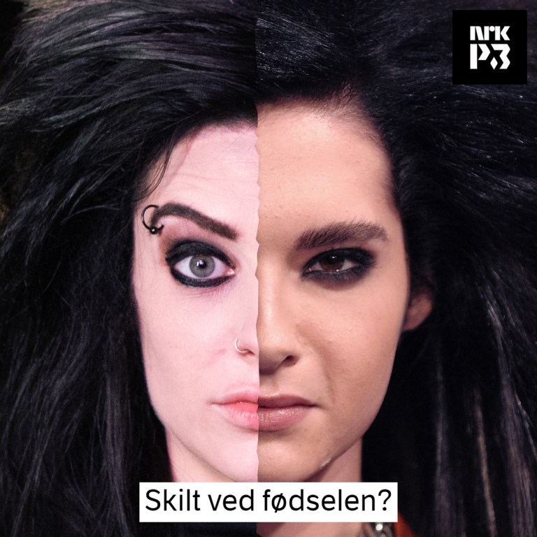 Link i bio: Skilt ved fødselen?