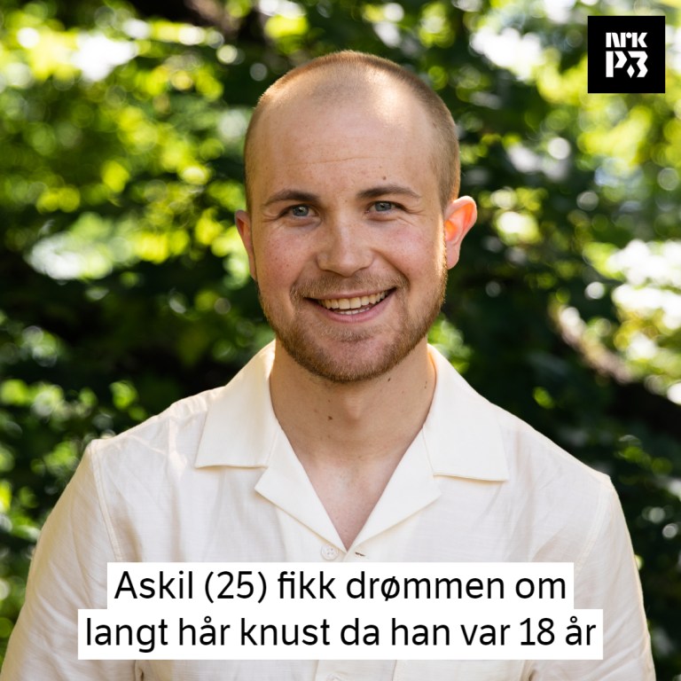 Link i bio: Askil (25) har nesten ikke hår: – Jeg driter i det