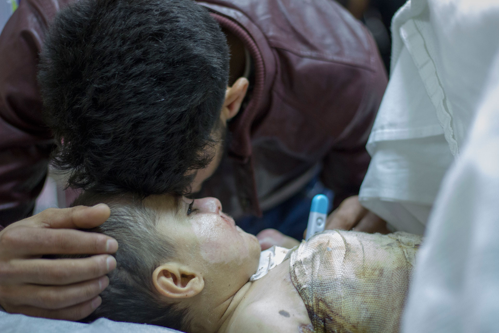 Nabaz mista den fem år gamle sonen sin Barez då ein gasstank i teltet deira eksploderte. Kona Bayan og sonen Bahez (2) overlevde så vidt. Foto: Siri Bråtveit
