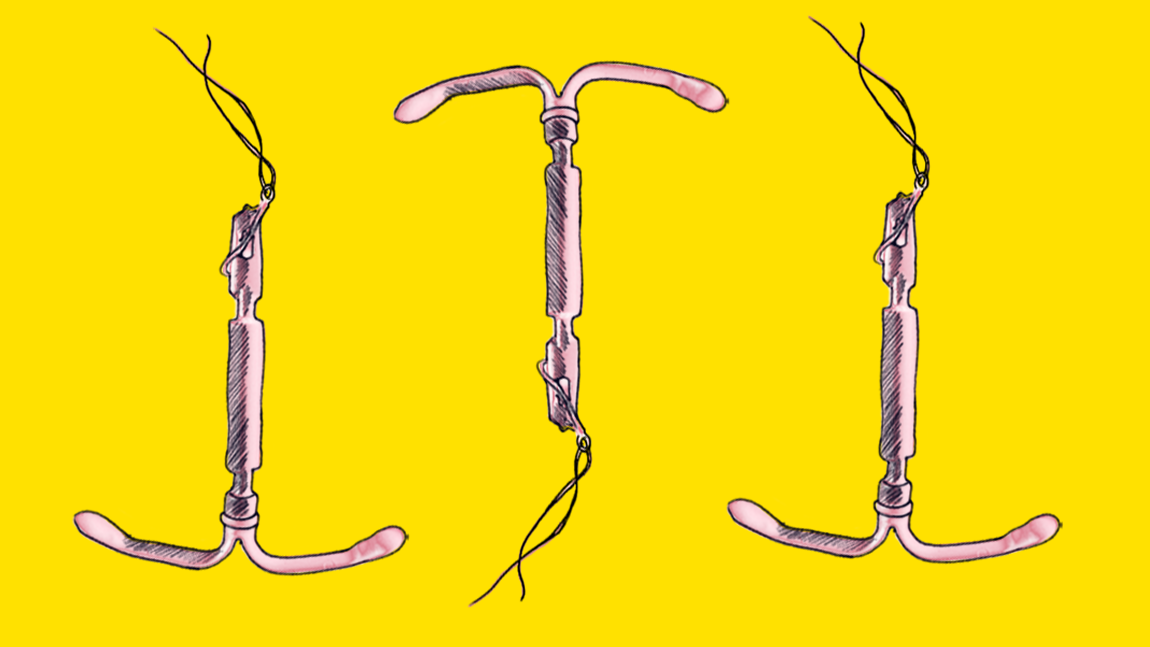 Tegning av tre hormonspiraler. Tegningen har gul bakgrunn og rosa illustrasjoner av spiralene, de har en stang med en snor hengende ut og to hekter som er formet som en t.