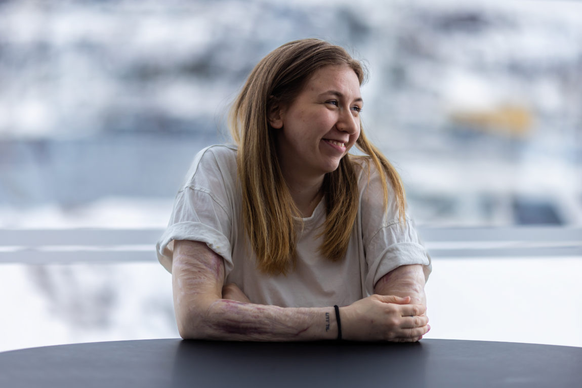 Silhuettene av Hedda står i kontrast med den vinterlyse bakgrunnen av Harstad. Hun smiler bredt til siden og ser på mange måte rolig og tilfreds ut. Armene hennes er godt planta i bordet hun sitter ved. Teksturene av arrene stikker frem. De ser ut som digre kjøttsår.